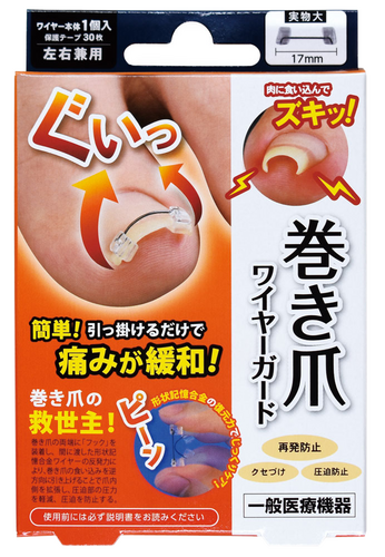 巻き爪ワイヤーガード