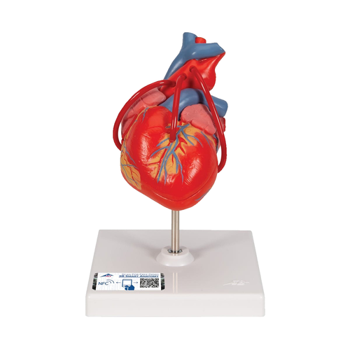 心臓 バイパス付・2分解モデル